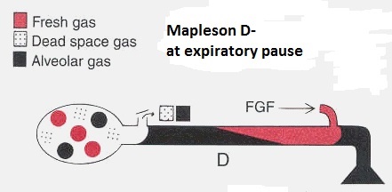 Mapleson D - How it works