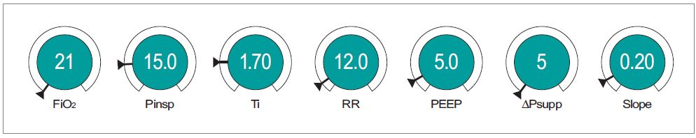 Example control settings for Perseus in PC-SIMV mode
